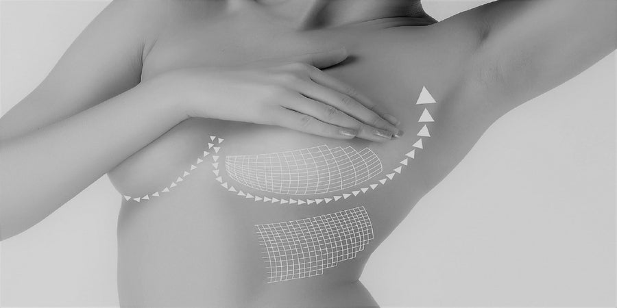 Breast lift and reconstruction